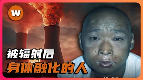 輻射對人的影響|核輻射如何對人體造成傷害？